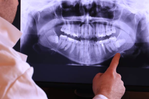 Best Emergency Treatment for Oral Infections in Steelevle, IL